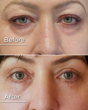 Slider image (5) Boroyan Plastic Surgery in Yerevan Armenia